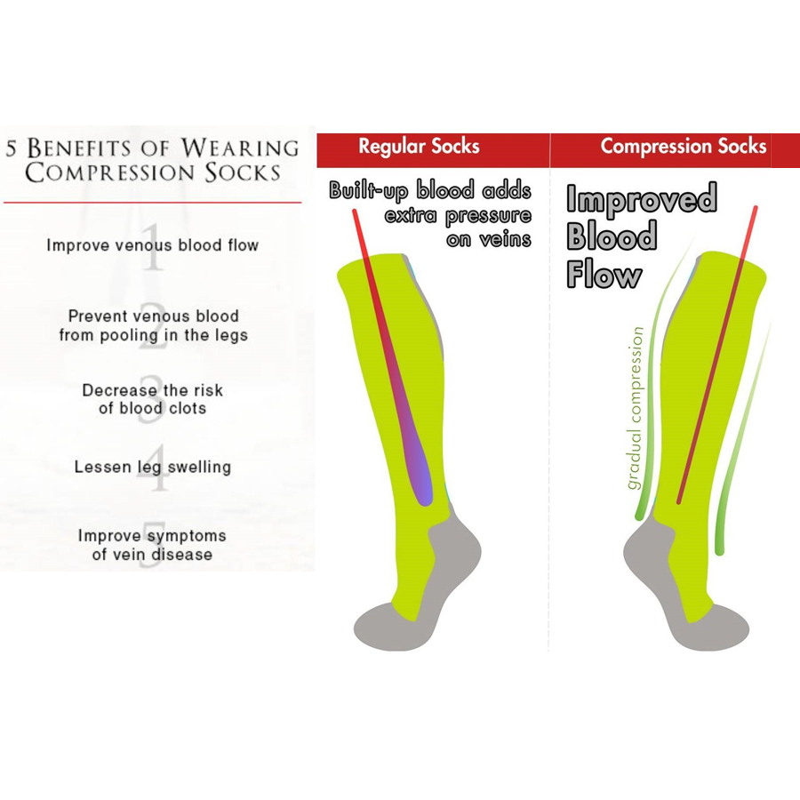 5 Benefits of Wearing Compression Stockings